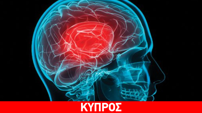 Χίλια εγκεφαλικά σημειώνονται ετησίως στην Κύπρο